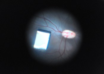 豬眼植入生物視網膜設備