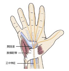 腕隧道症候群示意圖[1-4]