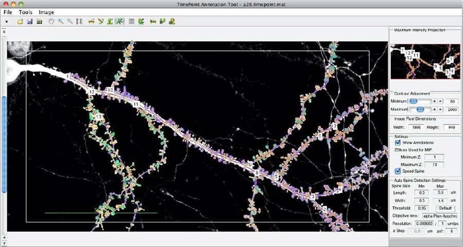 基於MATLAB的Spine Tool，用來將樹突棘的偵測、註記和分析自動化。